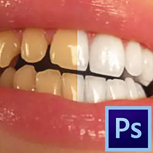 Cómo blanquear los dientes en Photoshop-2