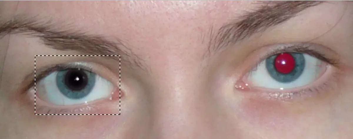 הסר את שיטת העיניים האדומות 2 (3)