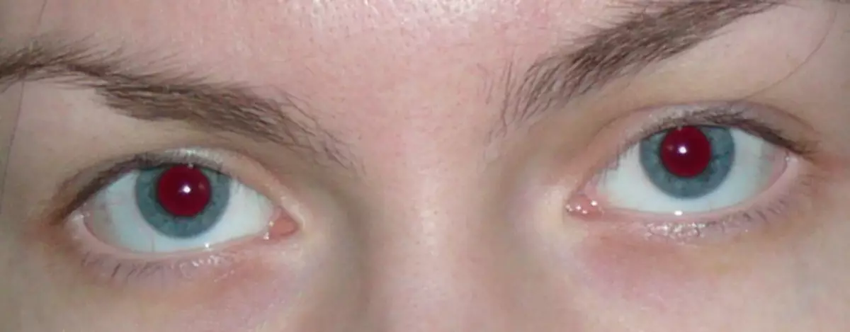 Odstranite metodo rdečih oči 2 (19)
